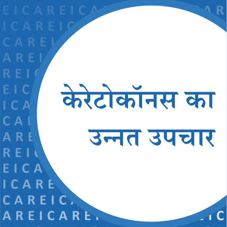 केरेटोकॉनस