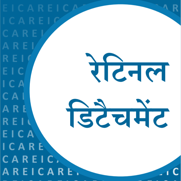 रेटिनल डीटैचमेंट